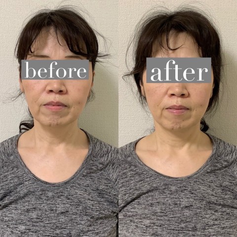 Before・Afterサムネイル